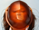 Extrém